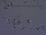 Amanita crassiputamen image