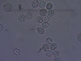 Amanita crassiputamen image