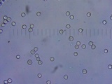 Amanita crassiputamen image