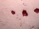 Fistulina hepatica image
