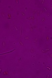 Dacrymyces stillatus image