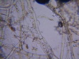 Hypomyces aurantius image