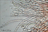 Sarcoscypha austriaca image