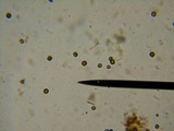 Geastrum coronatum image