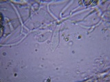 Resupinatus alboniger image