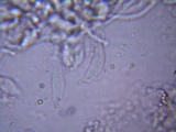 Resupinatus alboniger image