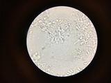 Sistotrema coroniferum image