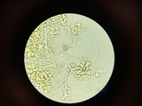 Sistotrema coroniferum image