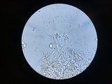 Corticium lombardiae image