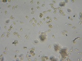 Ramaria incognita image