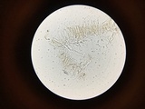 Dacryopinax elegans image