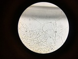 Dacryopinax elegans image