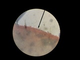Tectella patellaris image