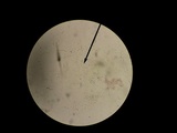 Tectella patellaris image