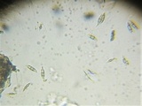 Anthostomella rubicola image