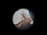 Anthostomella rubicola image