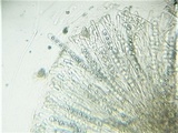 Trichophaea woolhopeia image