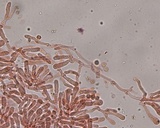 Rimbachia bryophila image