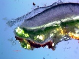 Lecanora meridionalis image