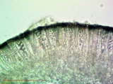 Lecanora meridionalis image