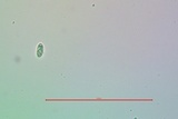 Lecanora confusa image