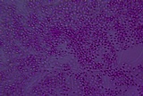 Helicogloea compressa image