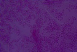 Helicogloea compressa image