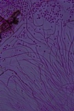 Helicogloea compressa image