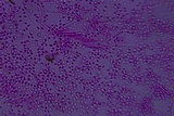 Helicogloea compressa image