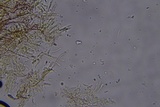 Scytinostroma protrusum image