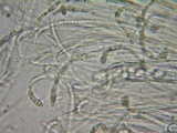 Otidea onotica image