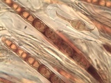Acrocordia conoidea image