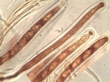 Acrocordia conoidea image