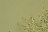 Aleurodiscus oakesii image