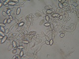 Botryobasidium conspersum image