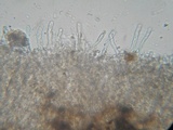 Hyphoderma subdefinitum image
