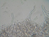 Hyphoderma subdefinitum image