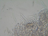 Hyphoderma subdefinitum image