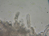 Hyphoderma subdefinitum image