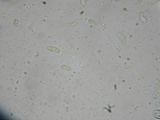Hyphoderma subdefinitum image