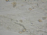 Galerina dimorphocystis image