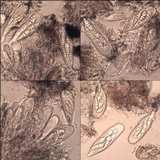Arthonia cinnabarina image