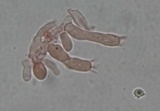 Trechispora farinacea image