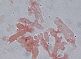 Trechispora farinacea image