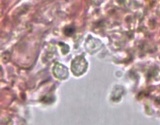 Trechispora farinacea image