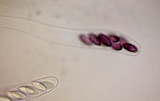Ascobolus denudatus image
