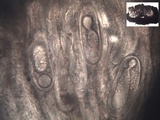 Pertusaria heterochroa image