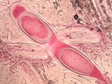 Pertusaria heterochroa image