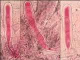 Pertusaria heterochroa image