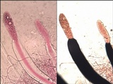 Pertusaria heterochroa image